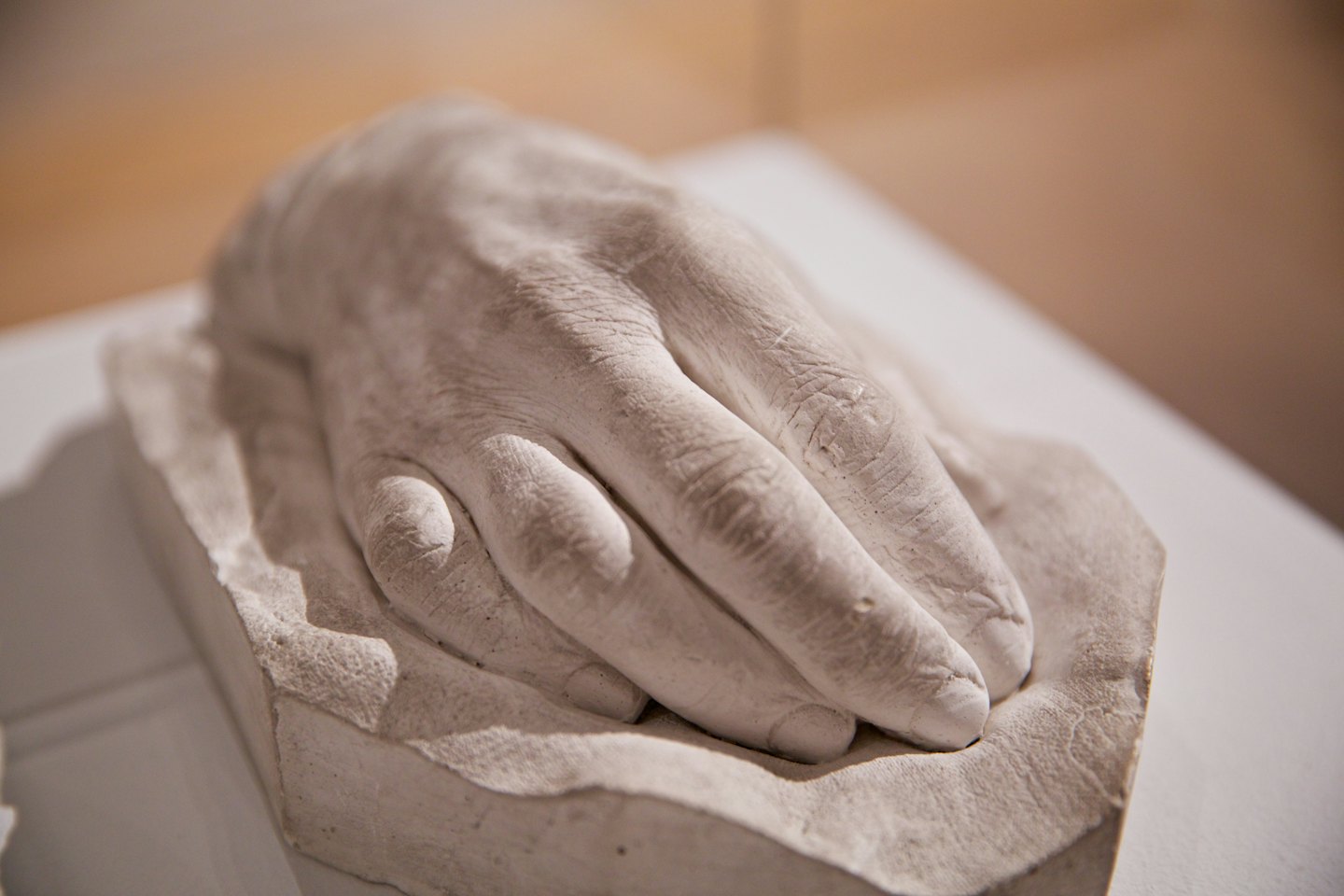 A plaster cast of a human hand rests on white.